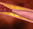 Magický cholesterol – víte, kolik je ho ve vaší krvi? 