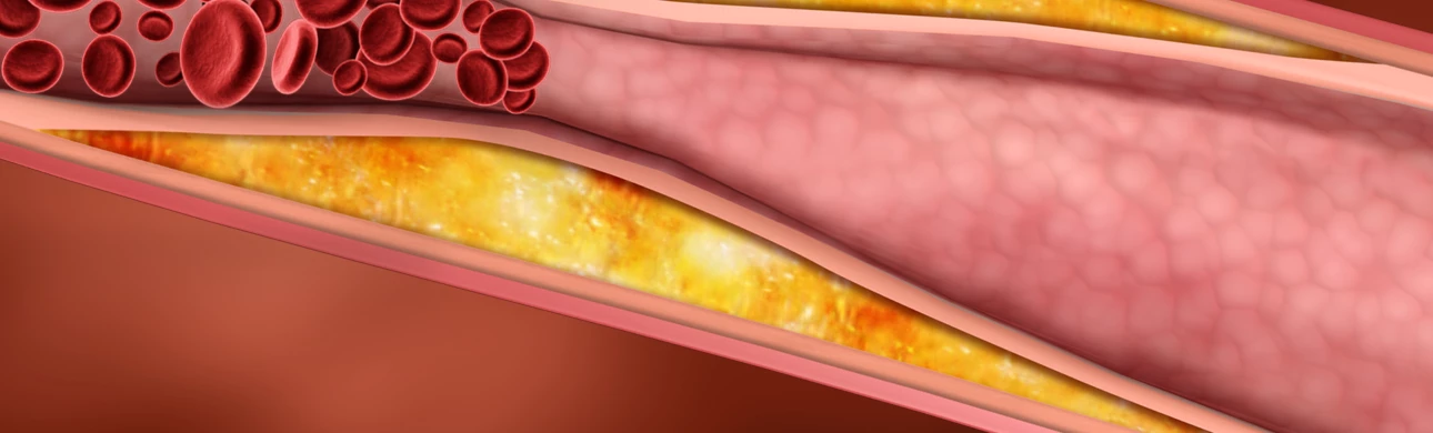 Magický cholesterol – víte, kolik je ho ve vaší krvi? 